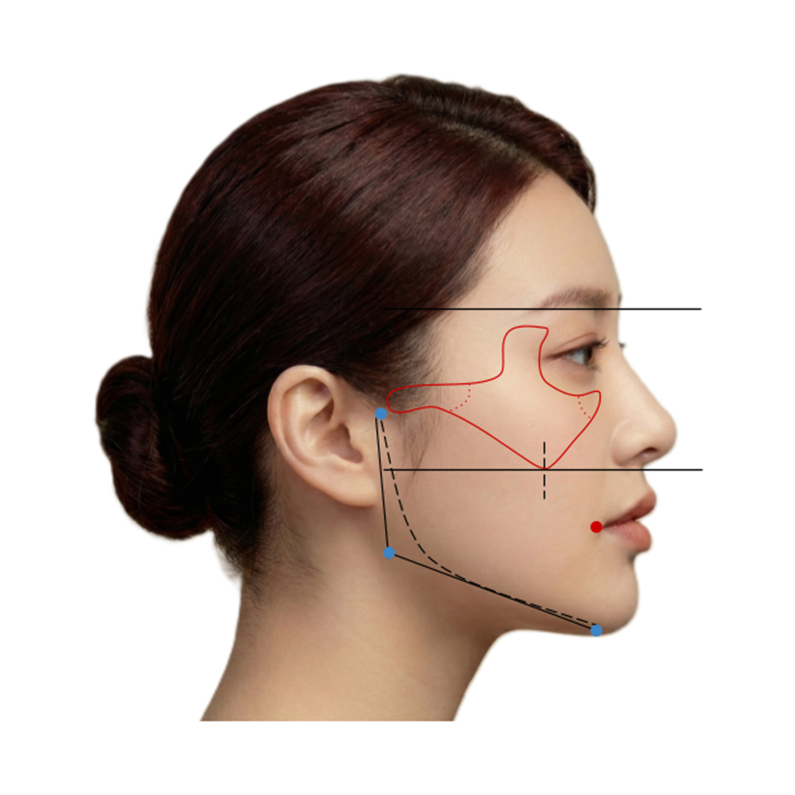 Tool Draping Using a Face Guide and an Eyelash Bar